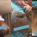 God bless all mothers" - Reactions as woman shares before and after  transformation of her stomach following child birth (Video) | Intel Region
